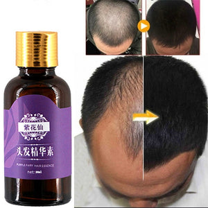 Hair Loss Products Natural With No Side Effects Grow Hair Faster Regrowth Hair Growth Products