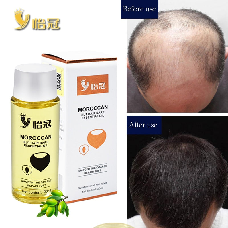 20ml Hair Oil Fast Hair Growth Essence Human Baldness Natural Herbal Powerful Hair Growth Treatment Fluid Anti Hair Loss