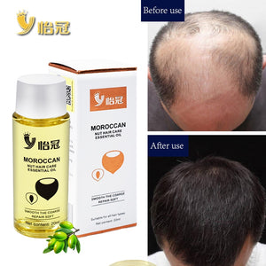 20ml Hair Oil Fast Hair Growth Essence Human Baldness Natural Herbal Powerful Hair Growth Treatment Fluid Anti Hair Loss