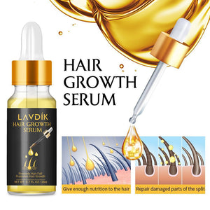 LAVDIK Ginger Fast Hair Growth Serum Essential Oil Anti Preventing Hair Lose Liquid Damaged Hair Repair Growing Women Men TSLM1